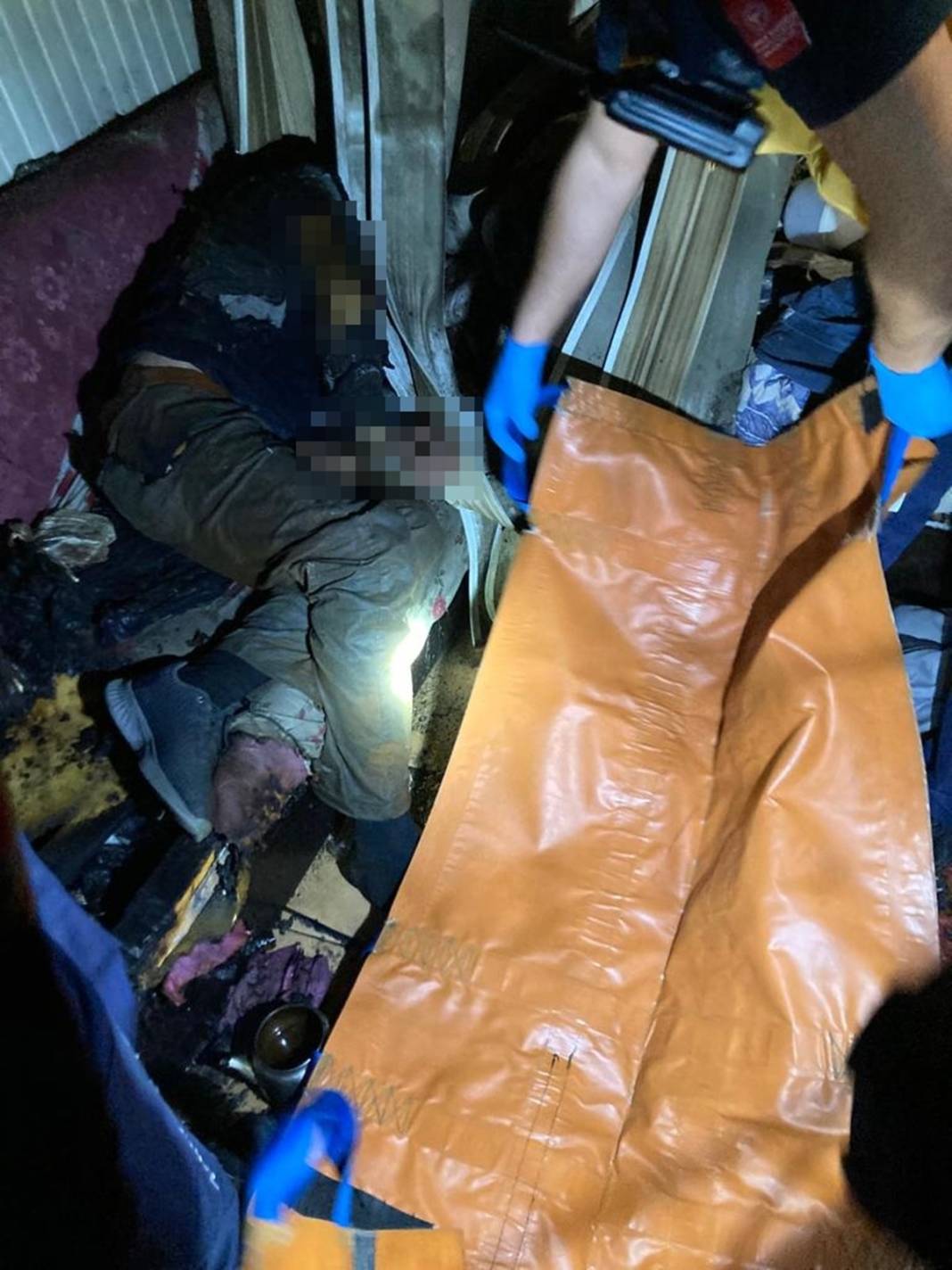 Elinde sigarayla uyuyakalınca ölümden döndü 3